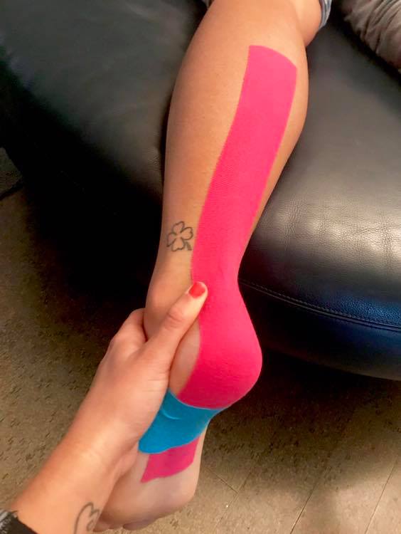 Kinesio taping