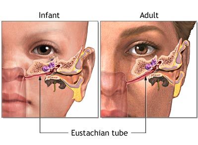 Osteopatia pediatrica